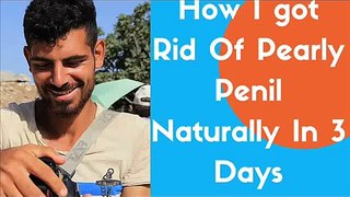 Pearly Penile Papules Removal at Home. Discover how I cured mine in 3 days.