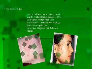 Acne free In 3 Days!