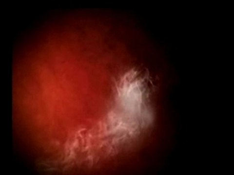 Renault 1001 surprises