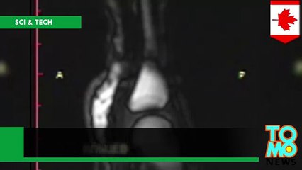 Исследователи сделали МРТ хруста суставами пальцев