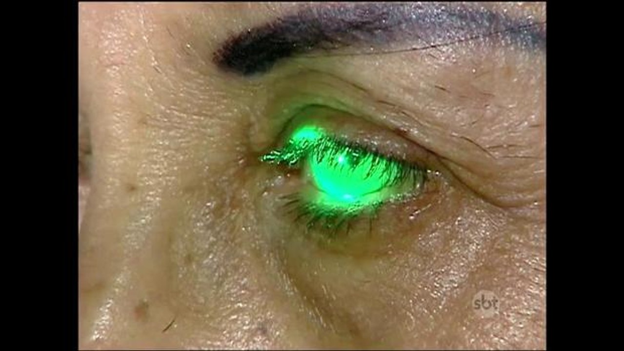 SP: Pacientes são infectados por bactéria durante cirurgia de catarata