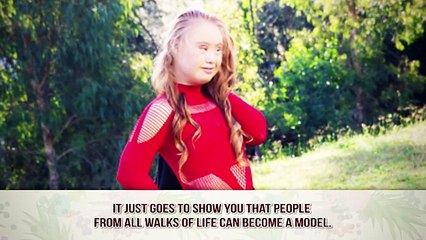 The Most Unusual Women Who Model