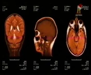 Cerebro: Limita tus opciones (Menos es mas)