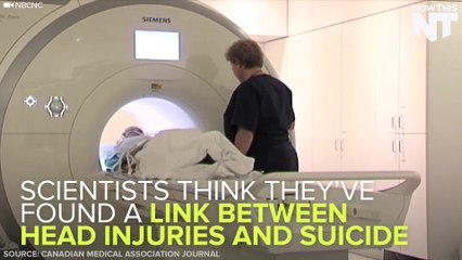 Researchers Find A Potential Link Between Concussions & Suicide Rates