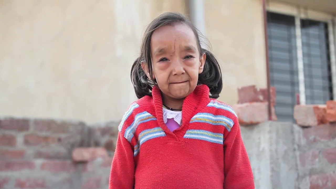 Inde : A 7 ans elle en paraît 10 fois plus à cause d’une maladie rare