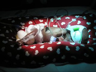 Miracle Baby - Kayleigh Anne Freeman