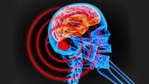 Brain Tumors – Does Cell Phone Radiation Cause Brain Cancer? || Healthy lifestyle