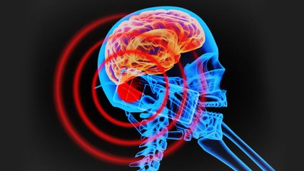 Brain Tumors – Does Cell Phone Radiation Cause Brain Cancer? || Healthy lifestyle