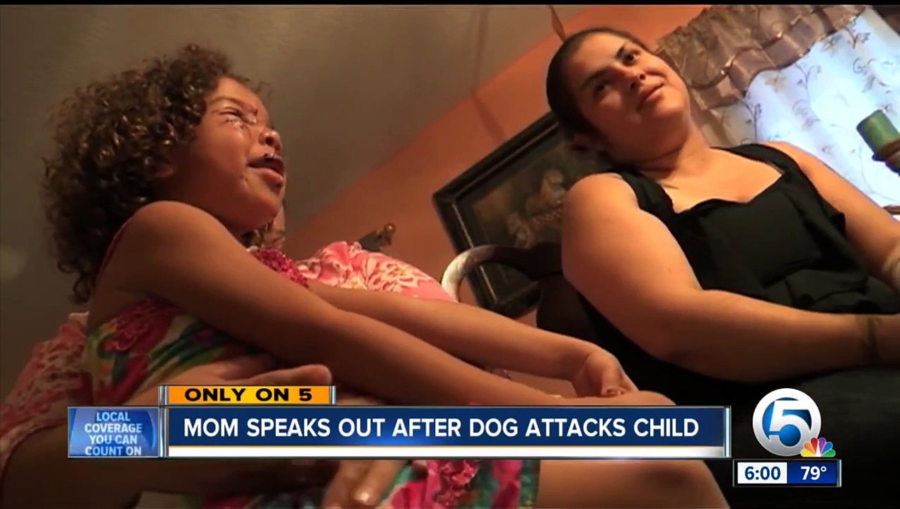 Un labrador attaque cette petite fille au visage