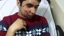 Polisin gaz kapsülü, 14 yaşındaki çocuğun yüz kemiğini çatlattı