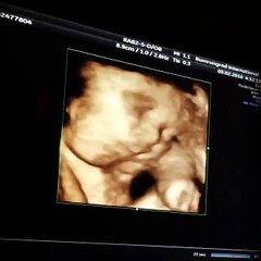 ต่าย ชุติมา อวดคลิปอัลตร้าซาวด์ลูกน้อย