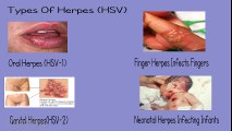 Herpes Dating Review Sites For People Living With Herpes
