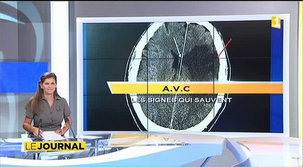 Face à un AVC, chaque minute compte