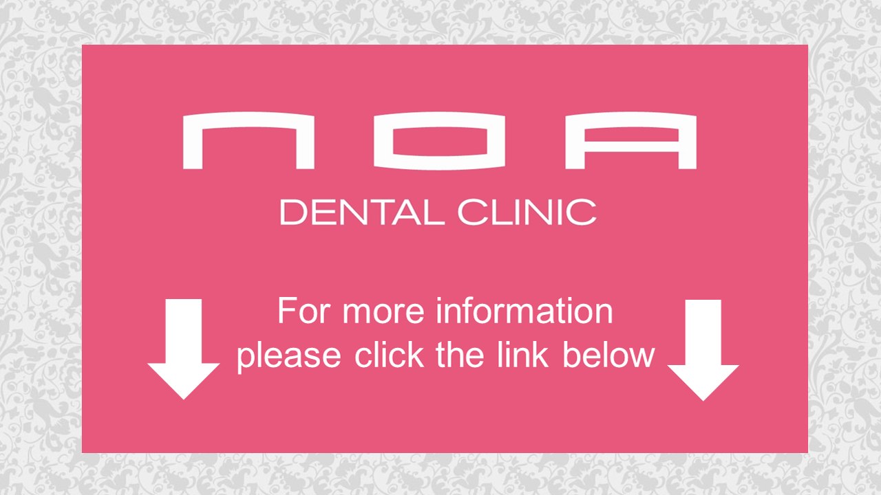 Best Teeth Whitening Bur Dubai Review +971 4398 7075