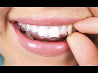 Best treatment orthodontist houston