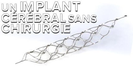 Stentrode : un implant cérébral pour contrôler des membres bioniques