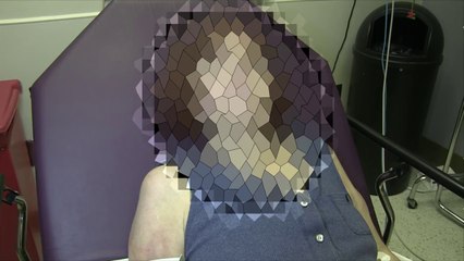 Vasculitis From Contaminated Cocaine