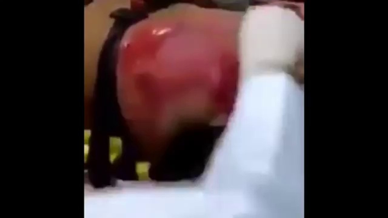 رجل يكاد قلبه يخرج من جسده بسبب شربه 24 مشروب طاقة