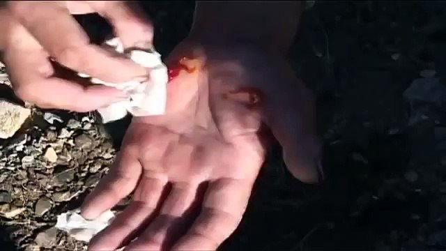 Орел нападает на человека