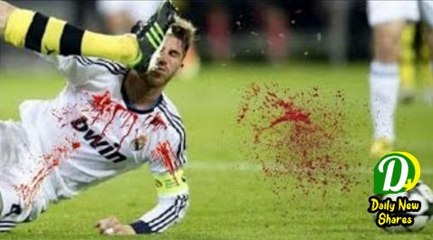 Top 10 Horrific Injury In Football • OUCH!