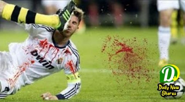 Top 10 Horrific Injury In Football • OUCH!