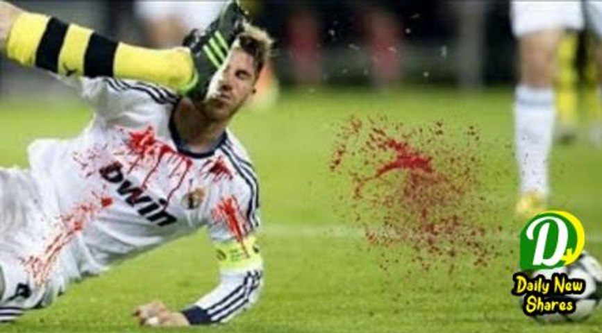 Top 10 Horrific Injury In Football • OUCH!