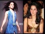 Indian actresses after and before plastic surgery