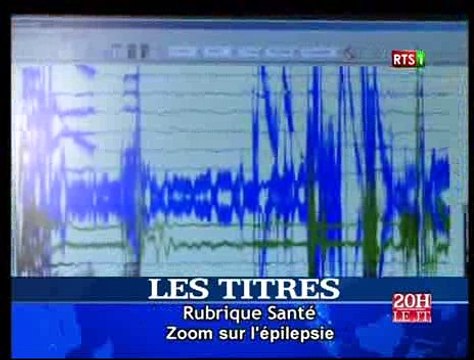 Journal Télévisé de la RTS1 du Journal du Jeudi 11 Février 2015 (Édition du soir)