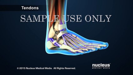 Anterior Ankle Fusion Surgery (Arthrodesis)
