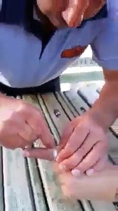 How to Remove a ring from finger