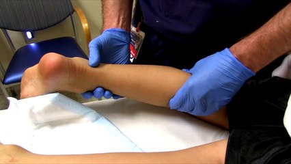 The Thompson Test For Achilles Tendon Injury