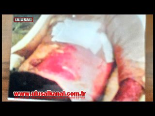 İşçinin canı kaç kuruş?