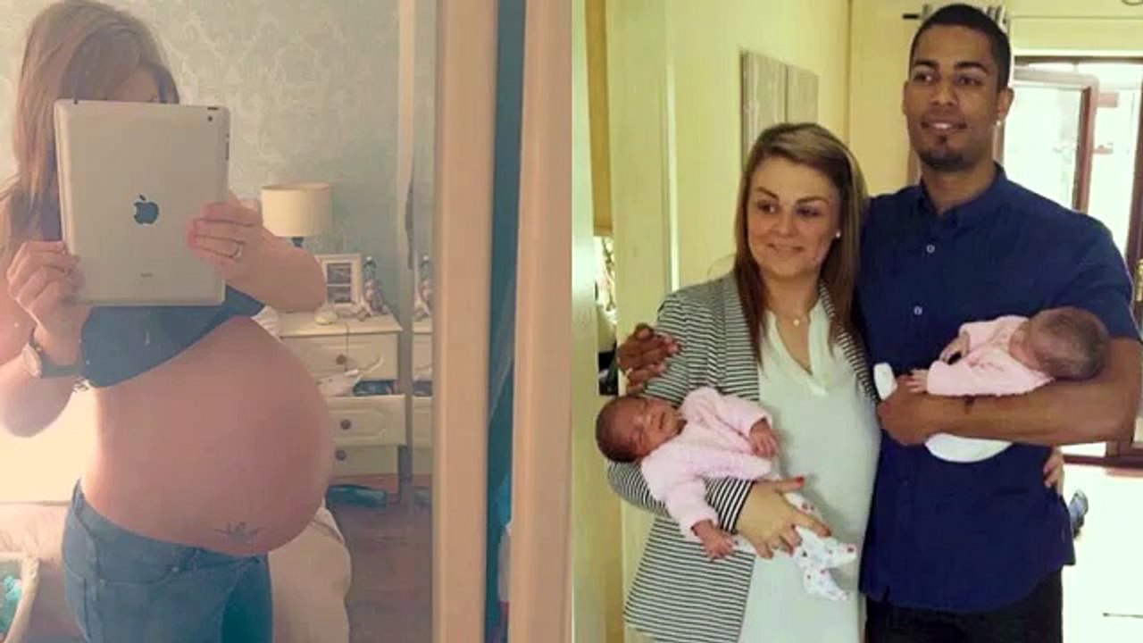 The black and white twins Mom gives birth to twins with different races