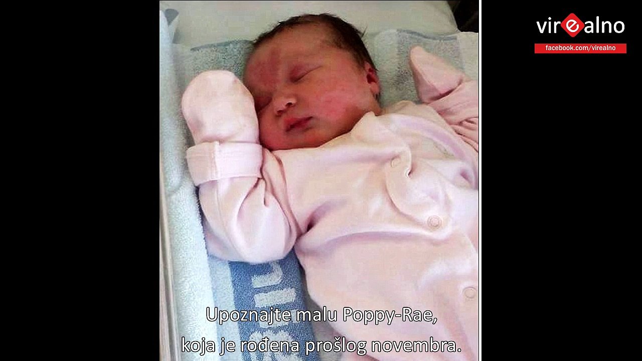 Mama rodila bebu sa madežom u obliku srca na čelu