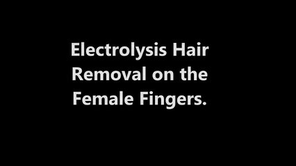 Electrolysis Hair Removal on the Female Fingers