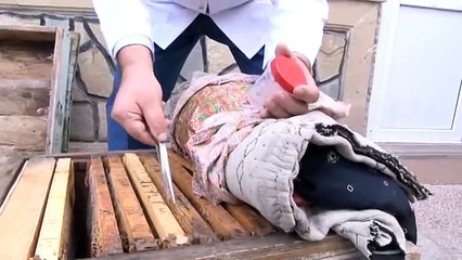 Migren için yeni umut sülük ve bal arısı tedavisi