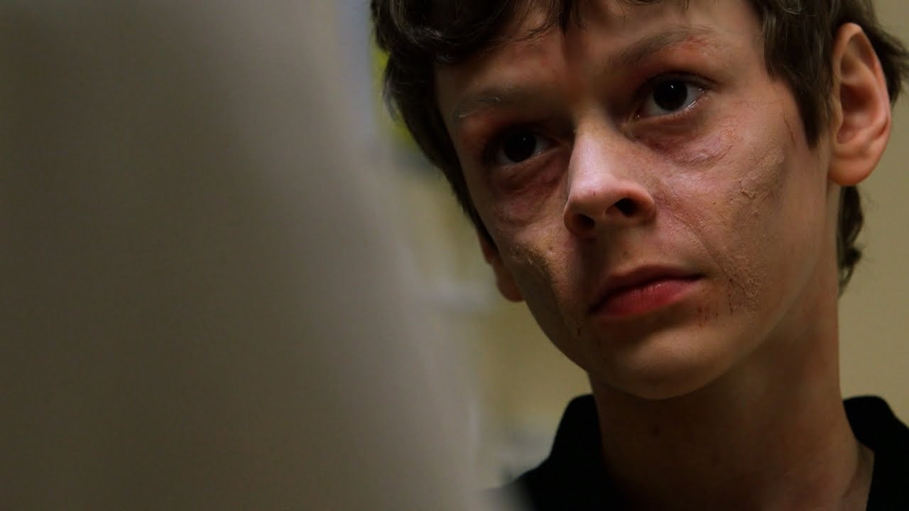 Meet A Boy with an Aggressive, Unstoppable Appetite Just Cannot Stop Eating