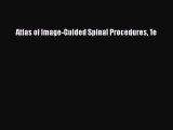 Read Atlas of Image-Guided Spinal Procedures 1e PDF Free