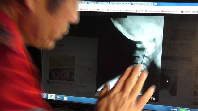 1366 Online treatment 網上治療