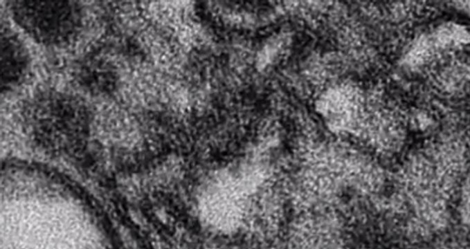 Вирус Зика добрался до России