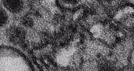 Вирус Зика добрался до России