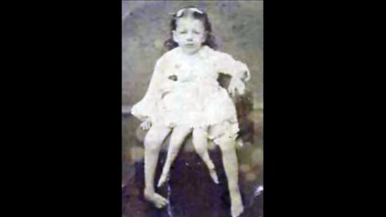 The four legged woman