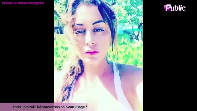 Exclu Vidéo : Anaïs Camizuli : Découvrez son nouveau visage !