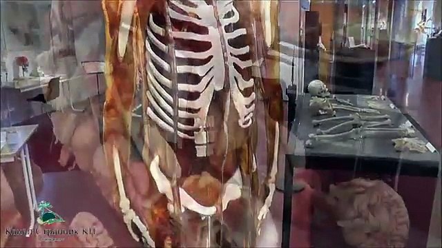 Анатомический музей Пластинариум в Германии Выставка человеческих органов