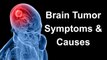 Brain Tumor Symptoms and Causes || Healthy Brain