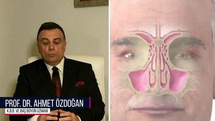 Sinüzit  - Prof. Dr. Ahmet ÖZDOĞAN