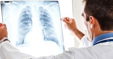 Sigara İçen Hastaya İlaç Vermeyen SGK'ya Dava