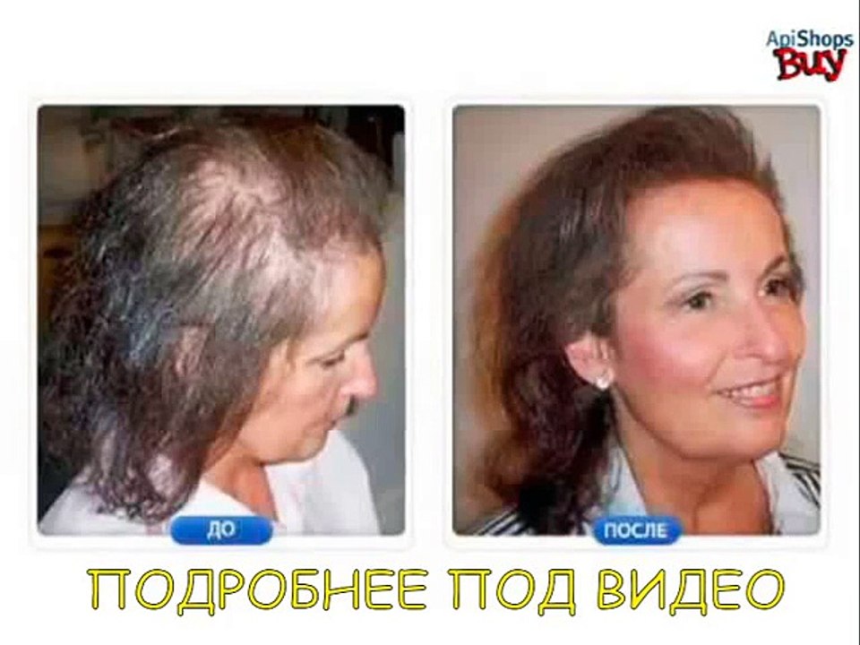[Fully Hair]