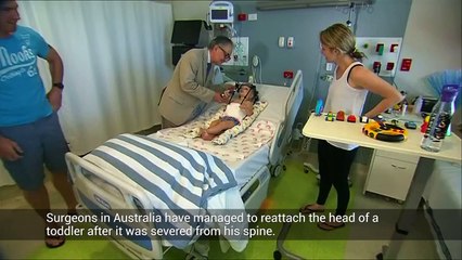 Australia: Doctors reattach childs head to spine after car crash