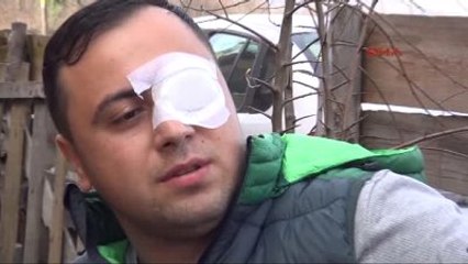 Zonguldak - Yaralı Uzman Çavuş: Bir Mermi ya da Bilye Bizi Yıldırmaz